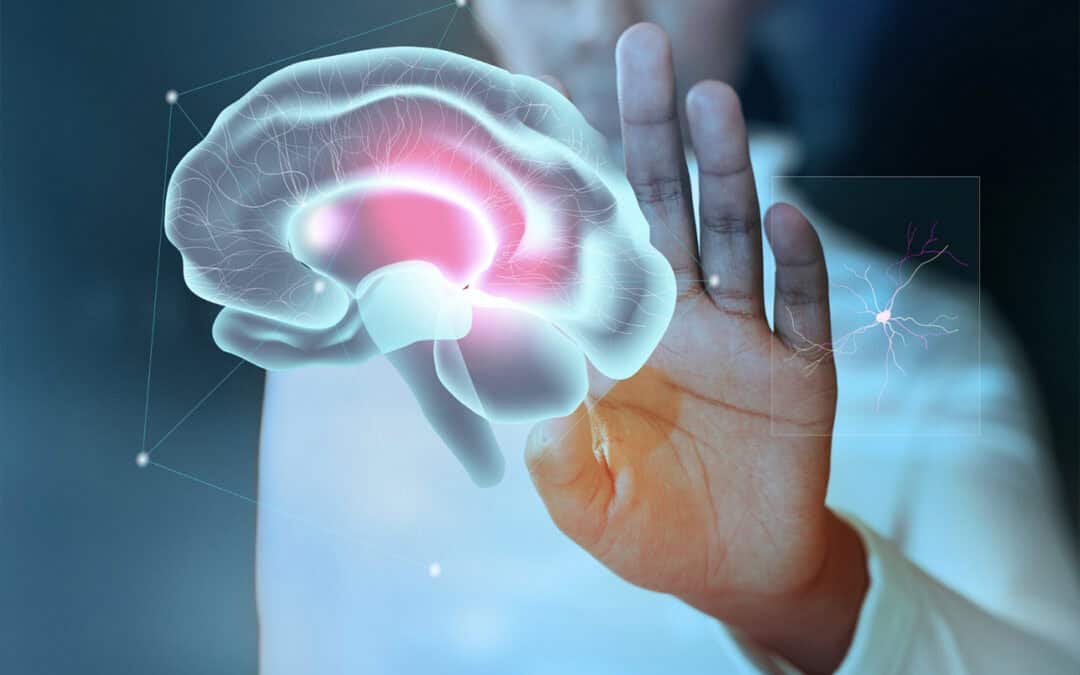 Il rischio di ictus è molto maggiore per gli adulti con DM1 rispetto a quelli con DM2