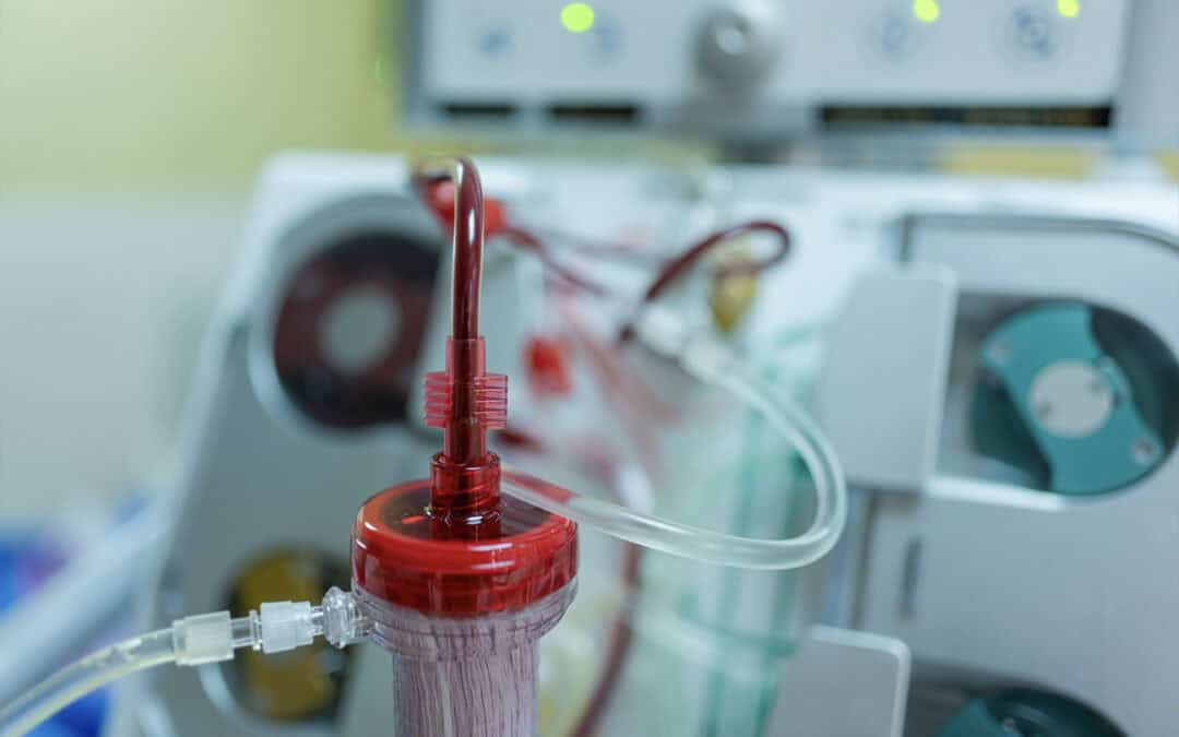 Gli agonisti del GLP-1 riducono il rischio di mortalità nei pazienti in dialisi