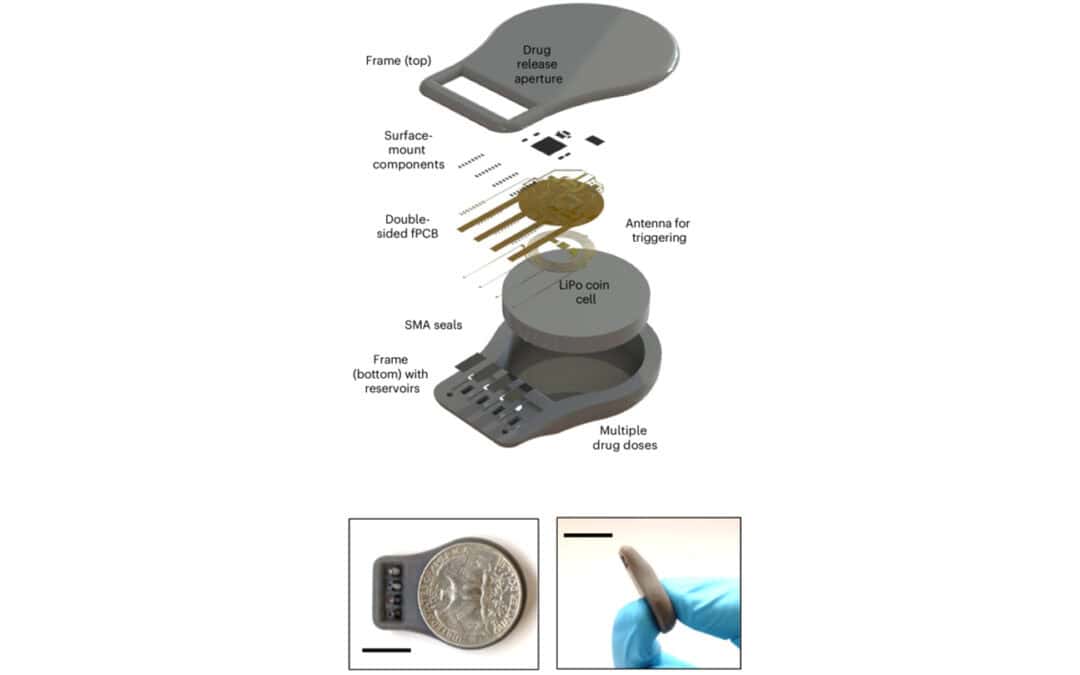 Allo studio un dispositivo impiantabile per il rilascio automatico di glucagone